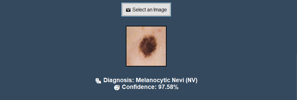 Skin Cancer Detection screenshot 3
