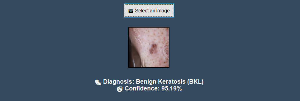Skin Cancer Detection screenshot 4