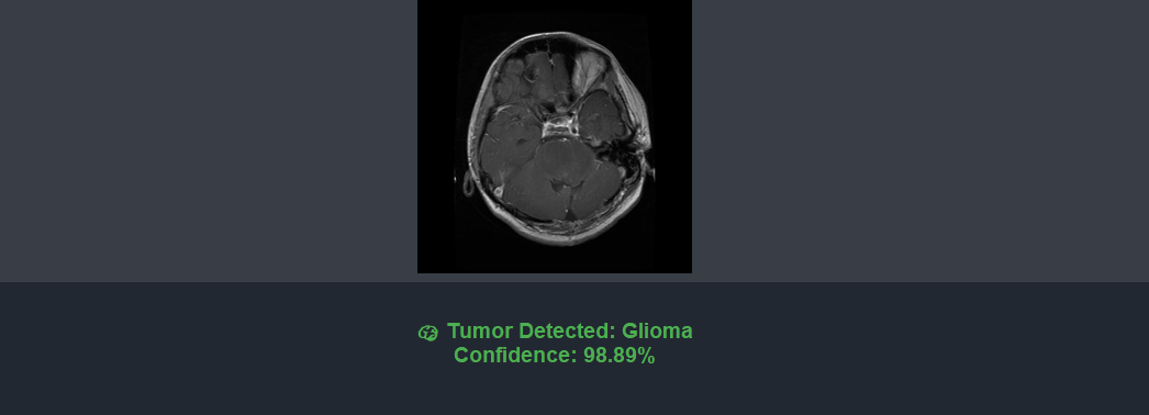 Brain Tumor Detection screenshot 3