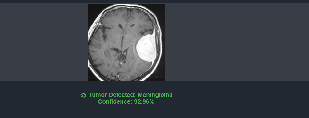 Brain Tumor Detection screenshot 4