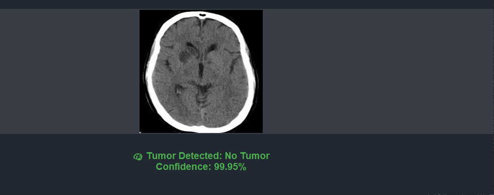 Brain Tumor Detection screenshot 5