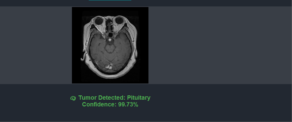 Brain Tumor Detection screenshot 6